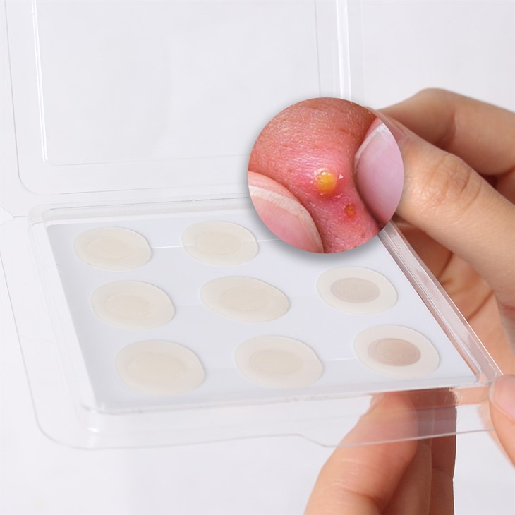 hydrocolloid acne patch